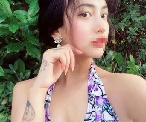 王海沐醫(yī)生雙眼皮案例分享