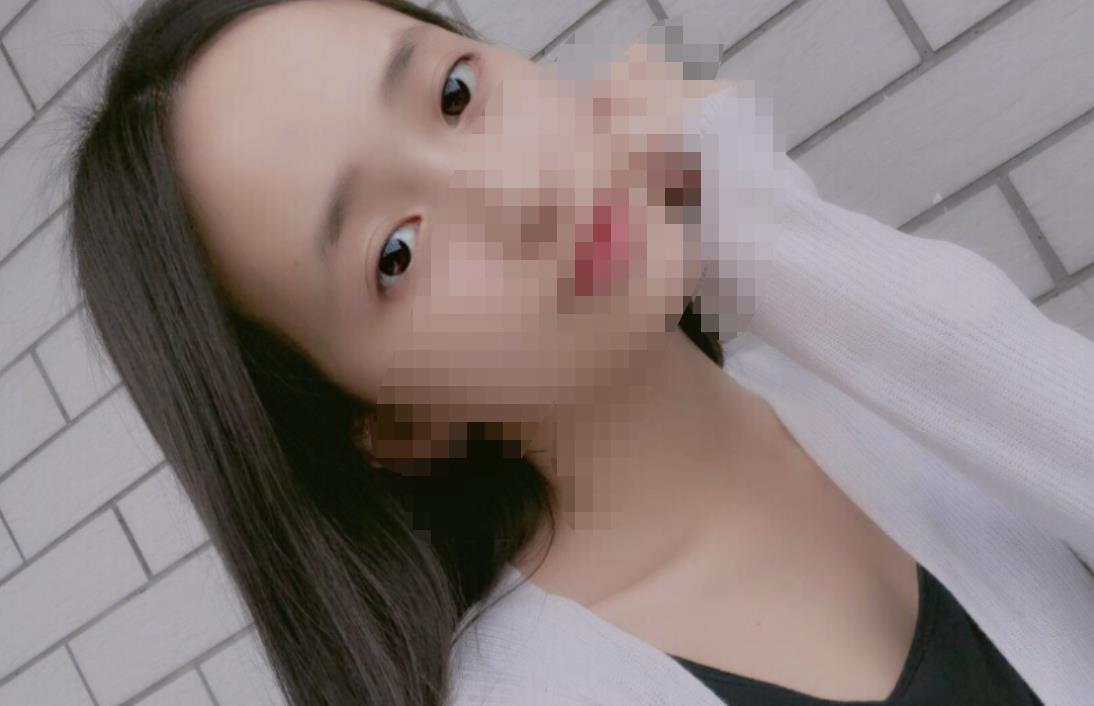 北京八大處趙延勇醫(yī)生做雙眼皮怎么樣？