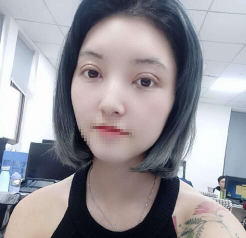 廣州奢媛醫(yī)療美容案例分享