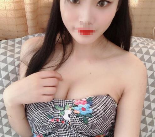 廣州艾菲莎醫(yī)療美容脂肪豐胸案例分享