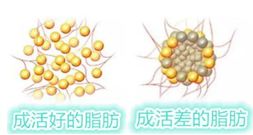 自體脂肪隆下巴的優(yōu)點(diǎn)