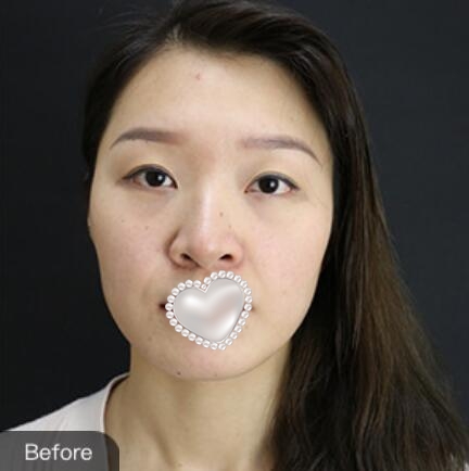 熱瑪吉除皺果圖