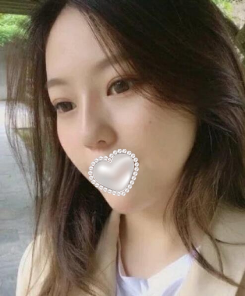 深圳四季醫(yī)療美容案例吸脂分享