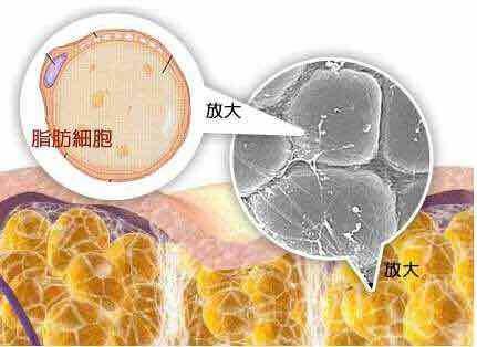 王洪醫(yī)生科普腰腹吸脂手術(shù)