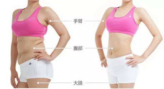 王洪醫(yī)生科普腰腹吸脂手術(shù)