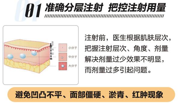 透明質(zhì)酸注射除皺