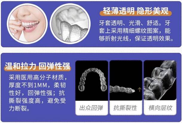 北京賽德陽光口腔醫(yī)院科普正畸知識