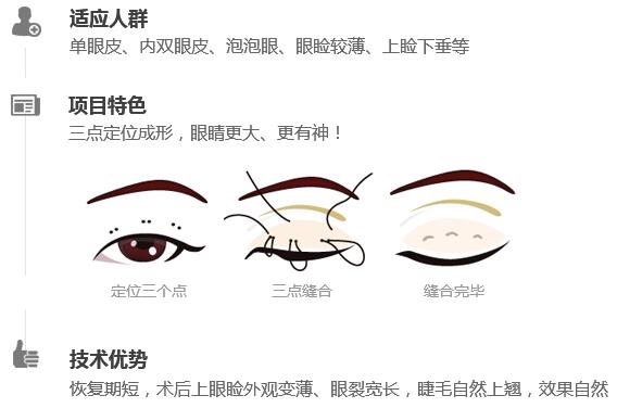 八大?處宋濤醫(yī)生雙眼皮知識科普 