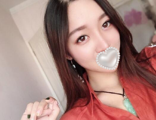 衡陽(yáng)雅美姚江華醫(yī)生脂肪填充?案例