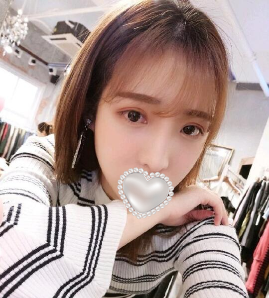 做歪鼻矯正果圖分享