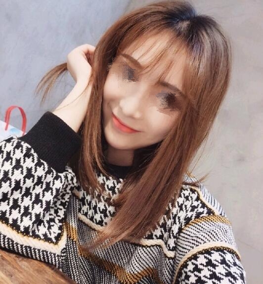 做歪鼻矯正果圖分享