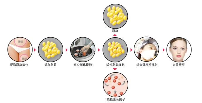 北京國濟中醫(yī)院科普面部填充