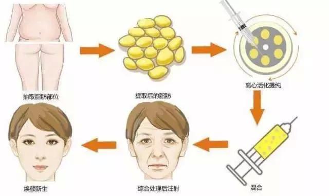 北京國濟中醫(yī)院科普面部填充