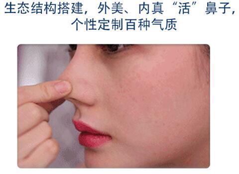 南寧華美林勇醫(yī)生科普隆鼻手術(shù)