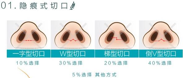 南寧華美林勇醫(yī)生科普隆鼻手術(shù)