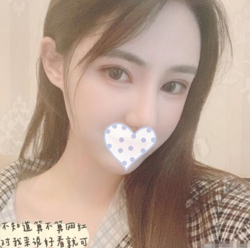 拉皮除皺手術(shù)果圖