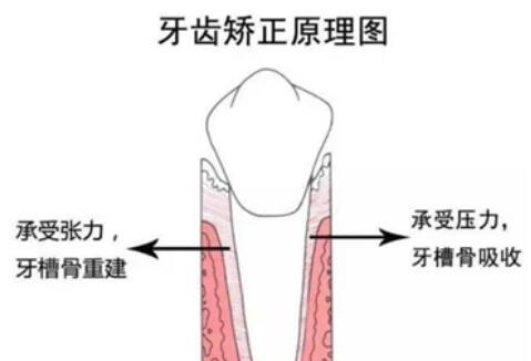 杭州市第三人民醫(yī)院口腔科科普牙齒矯正
