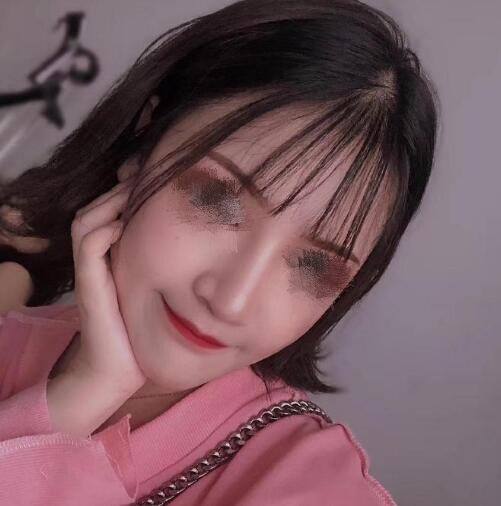 低鼻尖整形果圖對比