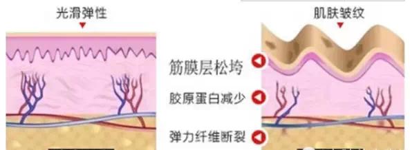 山東大學(xué)齊魯醫(yī)院整形美容科科普除皺手術(shù)