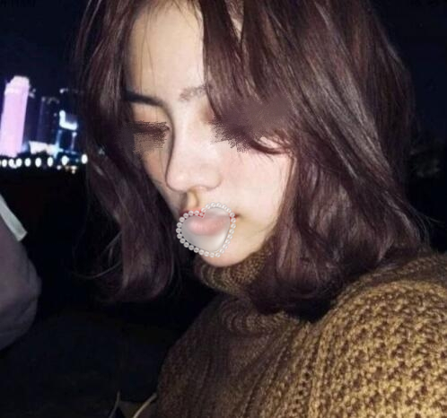 山東省立醫(yī)院整形美容科隆鼻案例