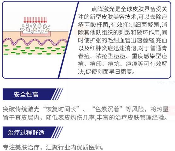 非剝脫性點(diǎn)陣激光