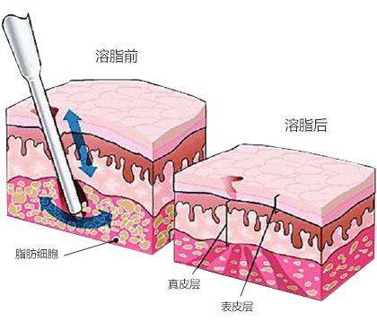 健康減肥的方法