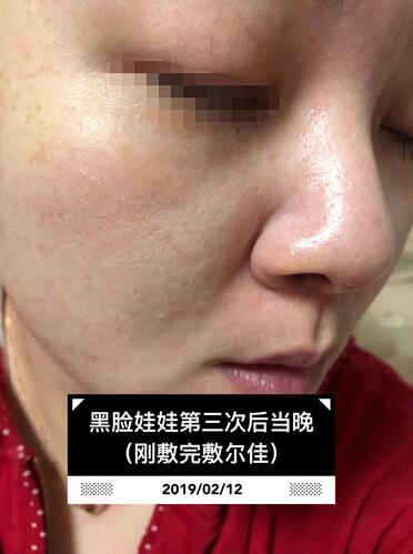 黑臉娃娃美容果圖分享