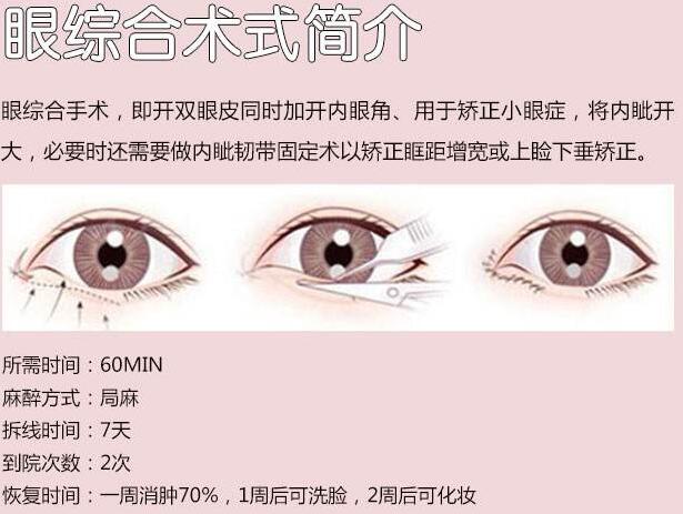 廣州海峽整形美容醫(yī)院科普雙眼皮手術(shù)