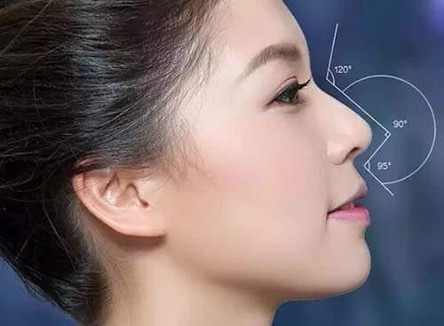 韓式自體軟骨隆鼻怎么樣？價格真人案例分享，絕美果誰能抵抗！