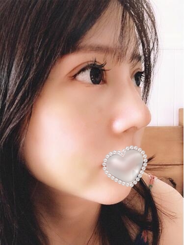 韓式自體軟骨隆鼻果圖