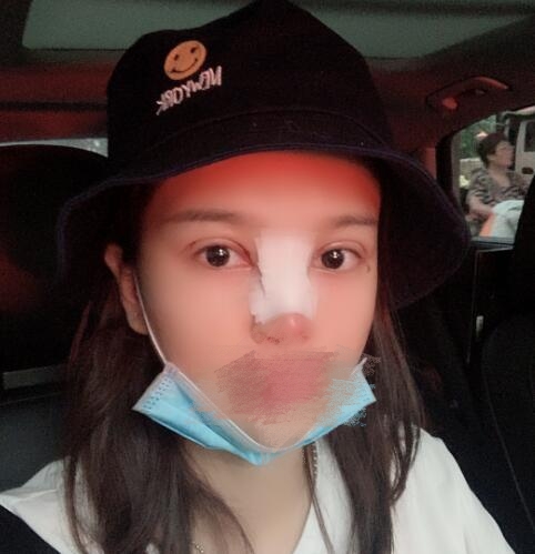 武漢五洲整形美容醫(yī)院案例分享