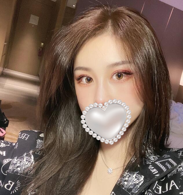 做隆鼻手術后果圖分享