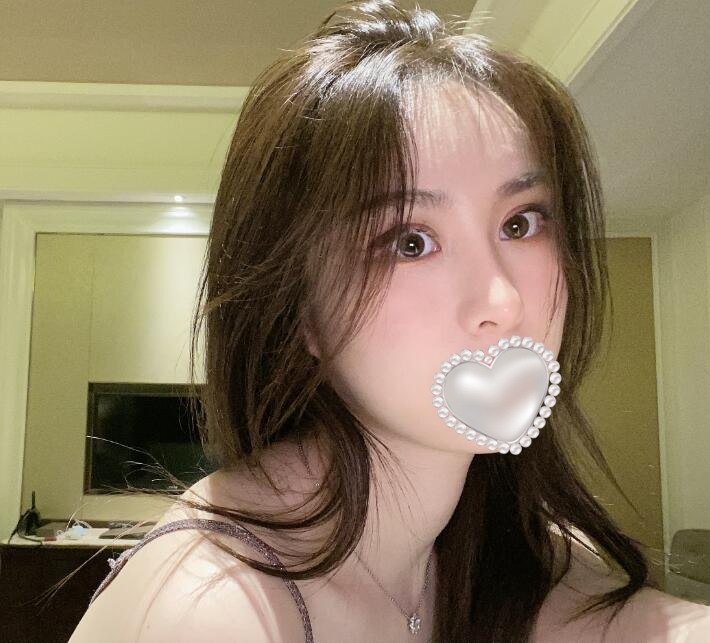 做隆鼻手術后果圖分享