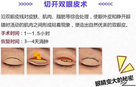 臺(tái)州中心醫(yī)院整形科普雙眼皮?手術(shù)