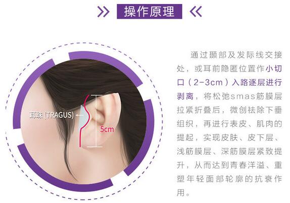 崔東俊醫(yī)生科普面部緊致提升除皺