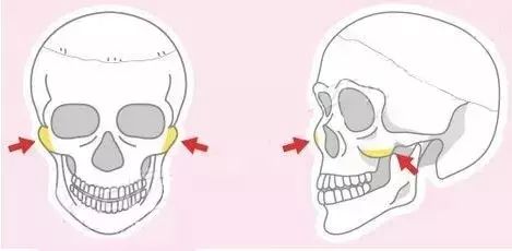 韓國原辰整形美容醫(yī)院科普面部輪廓手術(shù)?