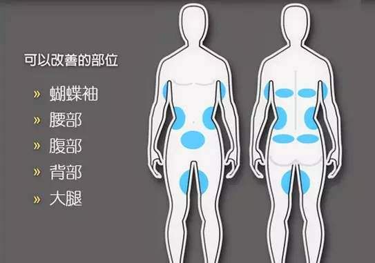 深圳鵬程整形醫(yī)院科普吸脂手術