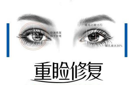 曹仁昌醫(yī)生科普修復(fù)雙眼皮手術(shù)