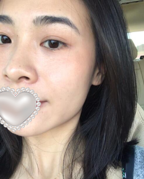 去黑頭黑臉娃娃果圖對(duì)比?