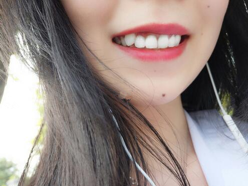 廣州牙齒整形種植牙果圖