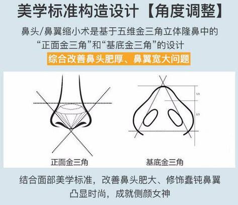 鼻翼肥大縮鼻頭鼻翼的方法