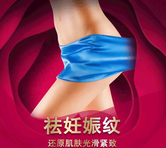 妊娠紋