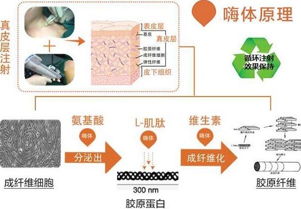 嗨體注射脖子除皺