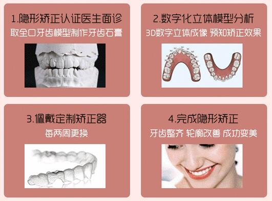 矯正牙齒的方式有幾種?