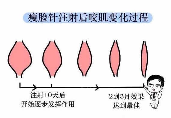 手術(shù)后常見問題有什么?