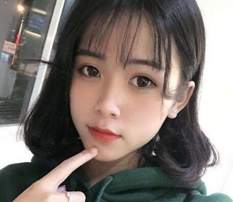 廣州伊麗莎白整形雙眼皮案例分享