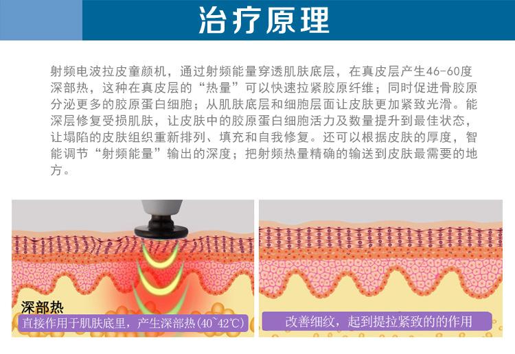 電波拉皮果怎么樣