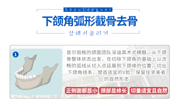 整瓜子臉需要多少錢