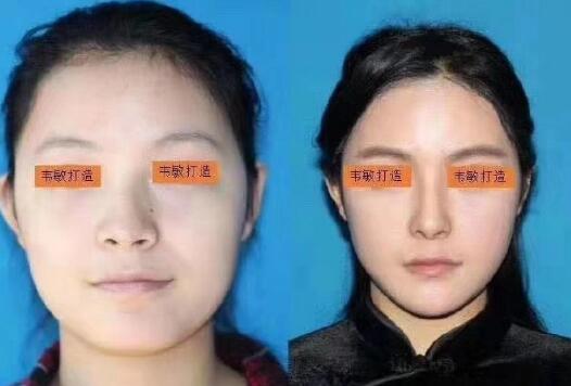 整瓜子臉果圖