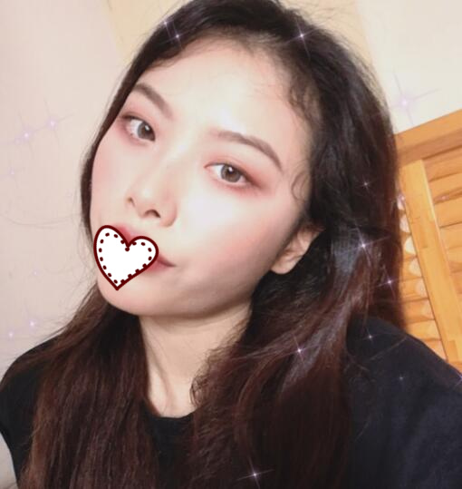 溫州雅美姬整形隆鼻案例分享